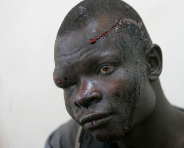 III nagroda w kategorii wydarzenia
Ranny w wyniku zamieszek etnicznych mężczyzna oczekuje pomocy lekarskiej w szpitalu w Nakuru. Kenia