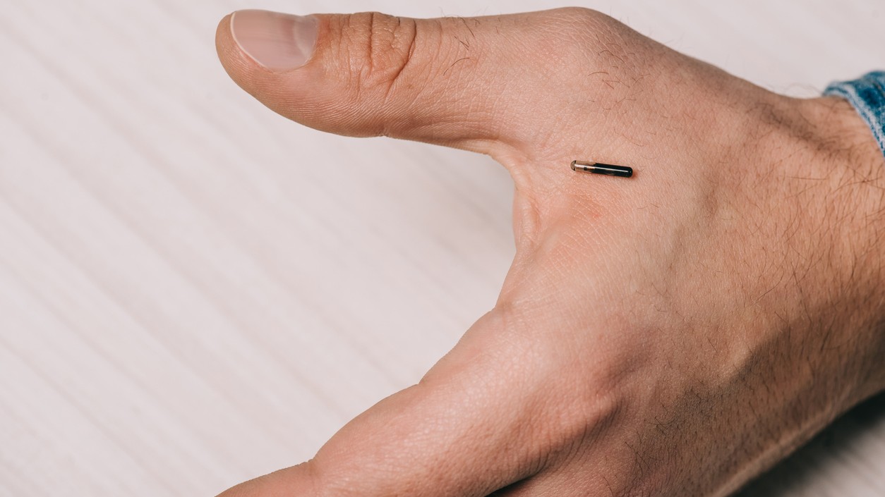 Kúzelník si nechal do ruky implantovať čip.(Ilustračné foto)