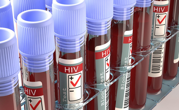 Próbki krwi do badania w kierunku HIV