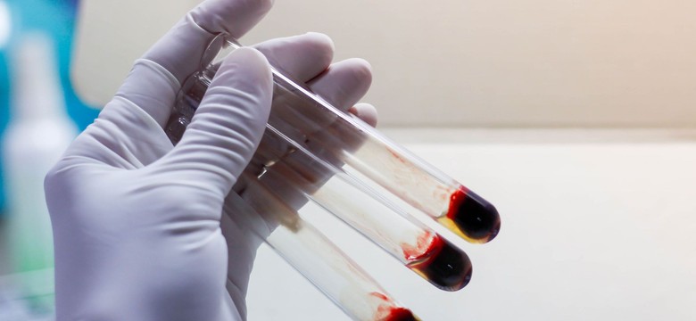 Badania laboratoryjne to jedno z najważniejszych źródeł wiedzy o zdrowiu