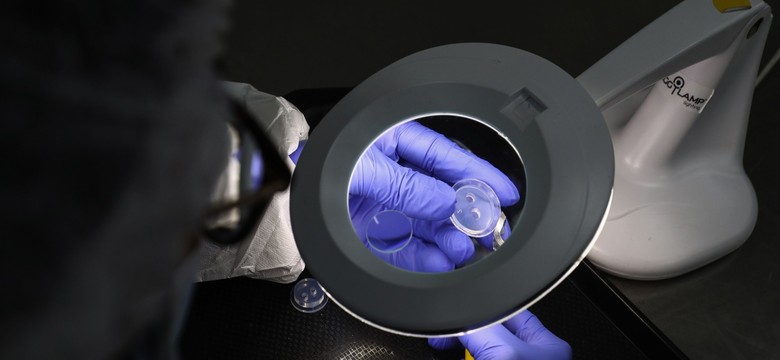 Komisja Zdrowia popiera refundację in vitro