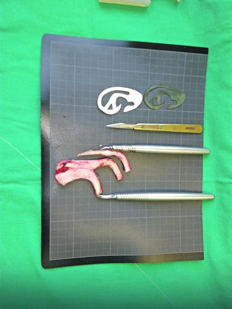 Rebarna hrskavica spremna za oblikovanje