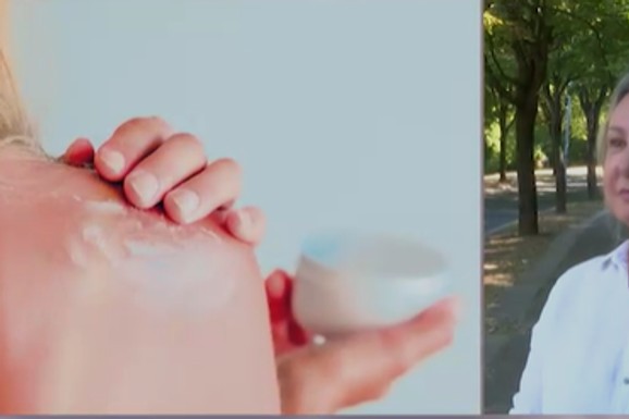 Zaboravite na kiselo mleko i jogurt: Dr Ćertić otkriva jedinu stvar koja zaista pomaže kad koža izgori na suncu