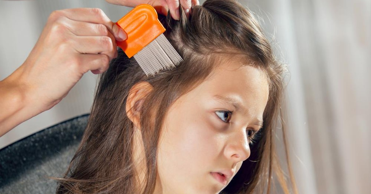 Gnidy Jak Pozbyc Sie Z Wlosow Jaj Wszy