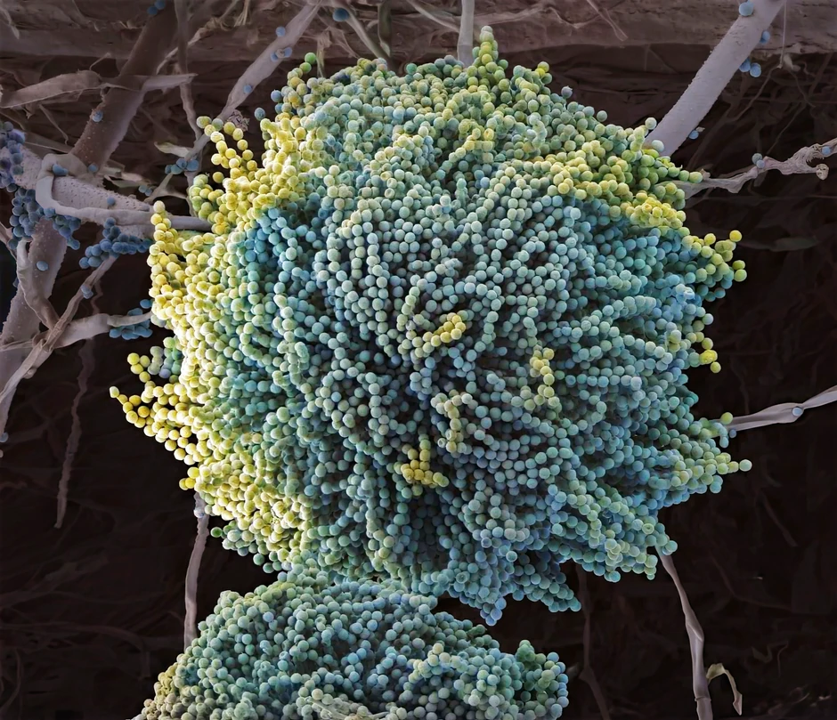 Aspergillus fumigatus