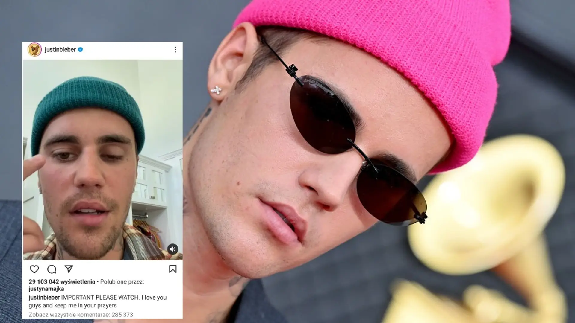 Justin Bieber ma sparaliżowaną twarz. Wyznał fanom, że cierpi na zespół Ramsaya Hunta