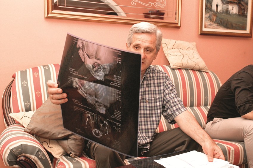 Miloradu Komrakovu je pod udarcima napukla jagodična kost