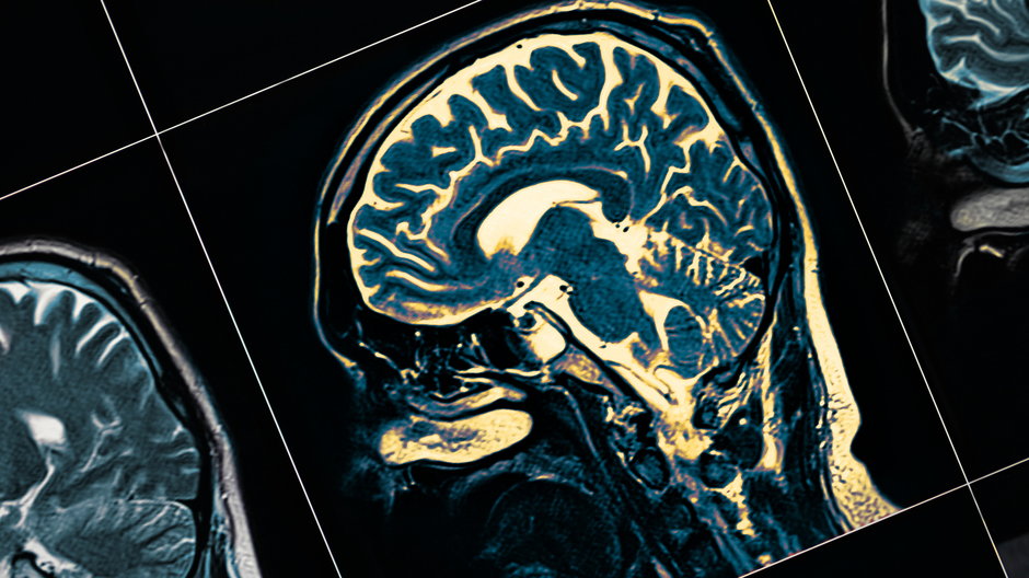 Obraz mózgu z rezonansu magnetycznego