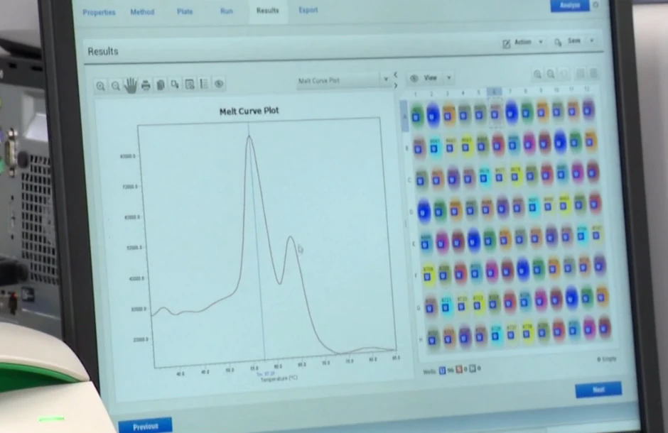 Signal da je dete negativno na spinalnu mišićnu atrofiju (SMA)