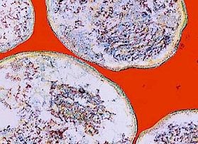 chlamydia-d0000180A76a7db3b3729