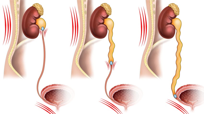 Prostatitis mindent megtesz XP prosztatitis kezelési diagram