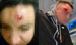 Atak na posterunek w Miliczu. Policja strzelała im w głowy