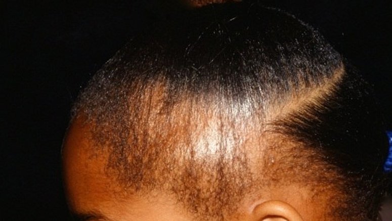 11 Reasons Why Your Natural Hair Is Not Growing Longer Pulse