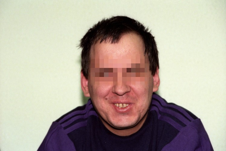 Leszkowi Pękalskiemu próbowano udowodnić 17 morderstw, popełnionych między 1984 i 1992, jednak z braku dowodów udowodniła tylko jedno, za co został skazany na karę 25 lat pozbawienia wolności. On sam w czasie procesów mówił o 90 ofiarach, ale potem swoje zeznania odwołał.