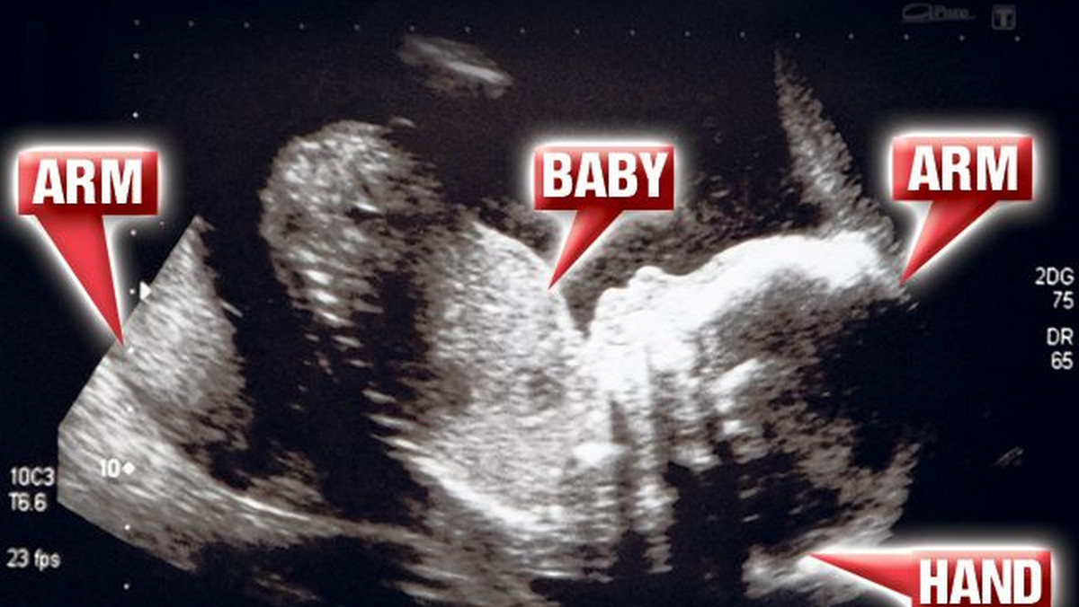 Kobieta w czwartym miesiącu ciąży twierdzi, że na zdjęciu USG jej dziecko jest otoczone przez ramiona swojego zmarłego dziadka - donosi "The Scottish Sun".