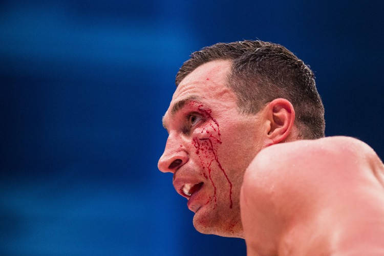 Tak Fury 'wlał' Kliczce i zabrał mu mistrzowskie pasy