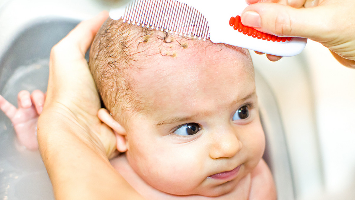 Ciemieniucha u niemowlaka - jak się objawia i jak ją leczyć?