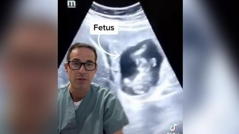 Dziecko w wątrobie kobiety. Lekarz nie mógł uwierzyć w to, co widzi