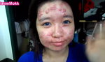 Straszna choroba skóry przykryta makijażem