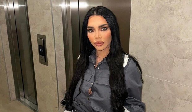 Ovako Helena Topalović izgleda sa svim operacijama