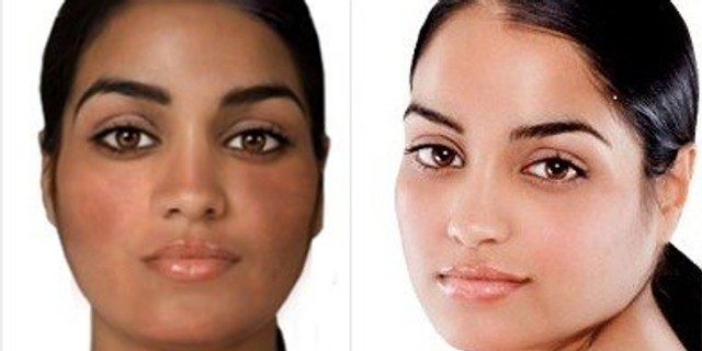 Skin 'bleaching'