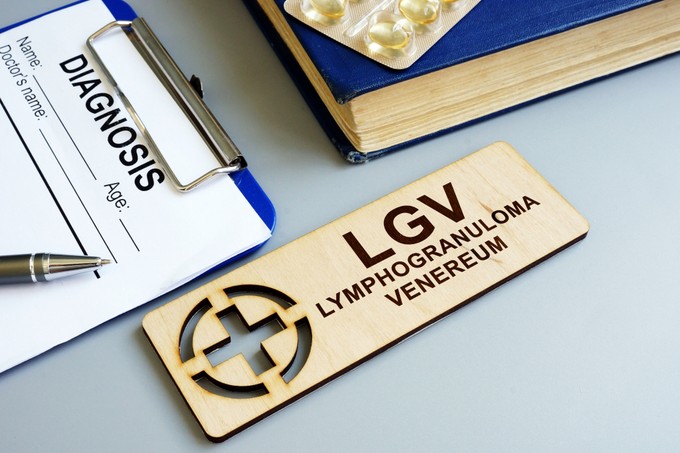 LGV (Lymphogranuloma venereum): oka, tünetei és kezelése
