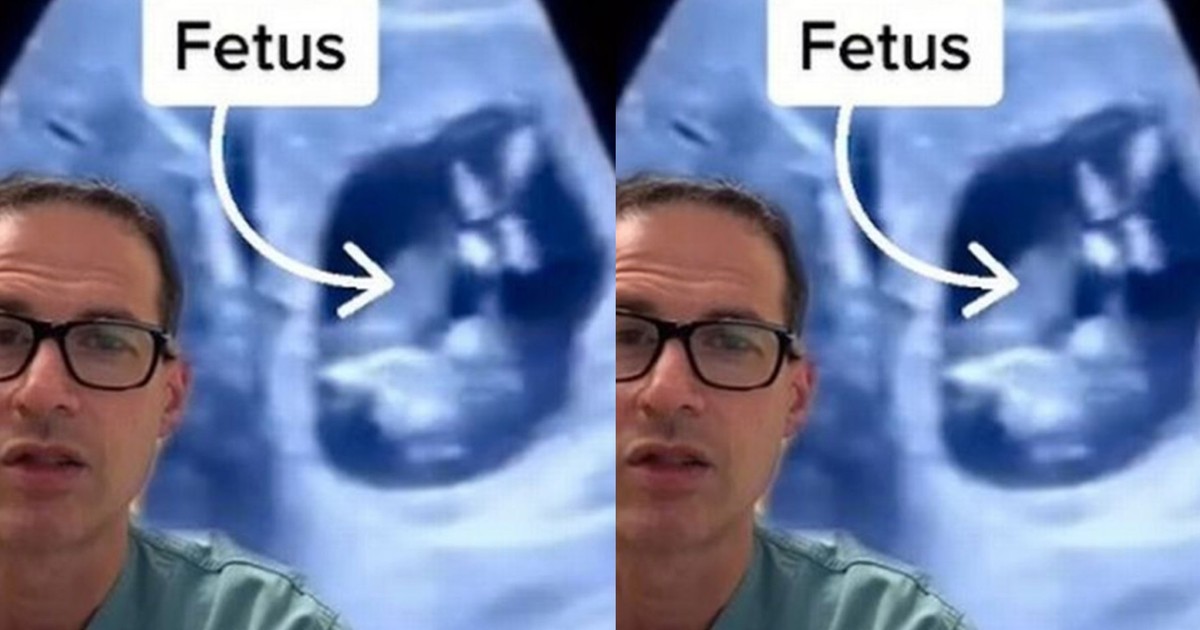 Doctors find baby inside woman's liver instead of the womb: "I thought I had seen it all" - Vimarsana News