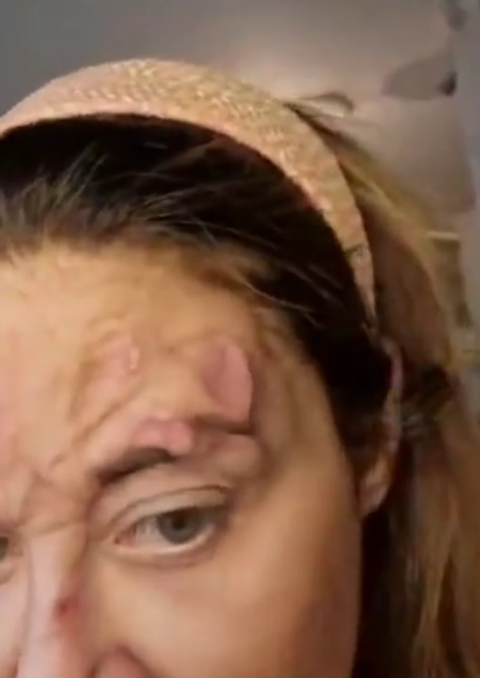 Ana Nikolić sa kožnim problemima