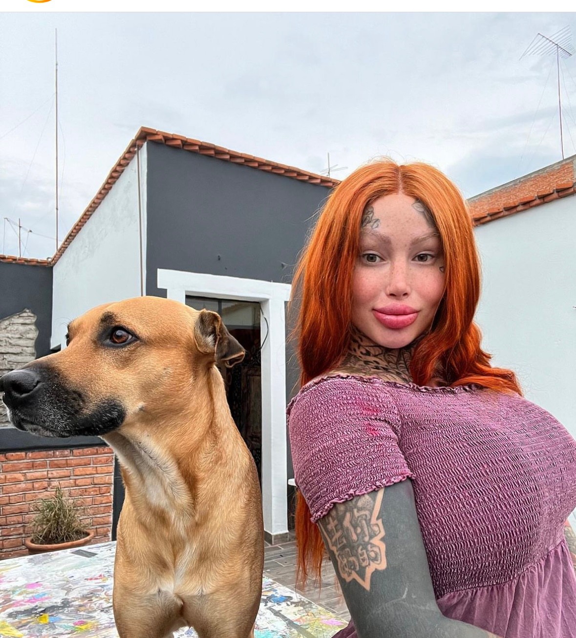 Mary sa rozhodla ísť opäť pod nôž.