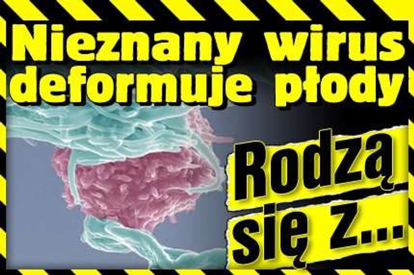 Nieznany wirus deformuje płody. Rodzą się z...