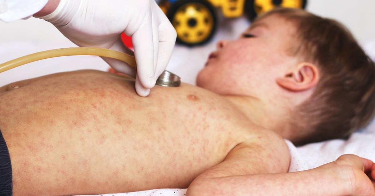 Odra w Polsce: rośnie liczba zachorowań na Podkarpaciu