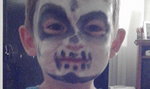 Pomalowała dziecko na Halloween. Chłopiec ma poparzoną twarz 