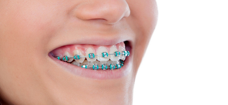 Ortodontyczny boom nad Wisłą. Równe zęby kuszą Polaków