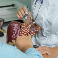 Májkárosodás, májzsugorodás: több betegség végstádiumára is jellemző