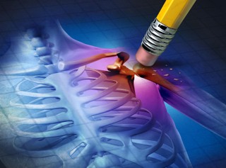 Precyzyjne uderzenie w osteoporozę