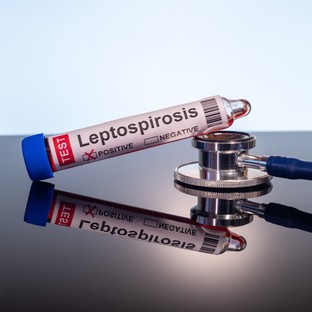 Leptospirózis