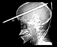 szigonyos-d0000135Bc6d6ccfe4432
