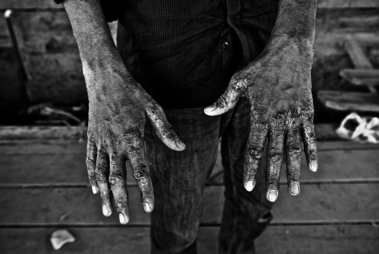 Uchodźcy w Suboticy, Serbia