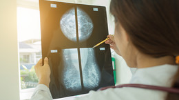 Rak piersi najczęstszym nowotworem kobiet - znaczenie profilaktyki. Mammografia może uratować życie
