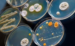 Oporna na antybiotyki superbakteria w Warszawie. Błyskawicznie się rozmnaża [WIDEO]