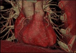 cardio001-d0000016327dab63291a9