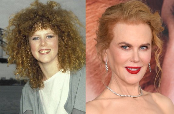 Nicole Kidman w 1983 r. i obenie