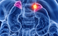 Wyhodowano nadnercza z komórek macierzystych