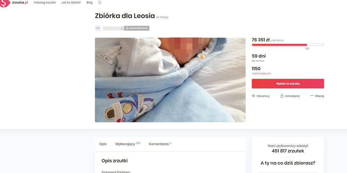 Koronawirus w Polsce: zbierają pieniądze na Leosia z Janowa Lubelskiego