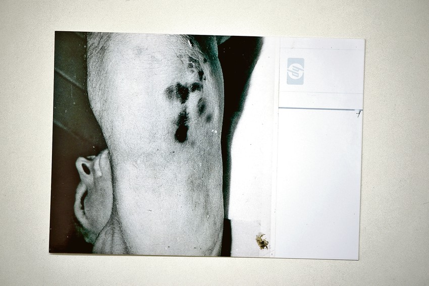 Milos Milosević, autopsija