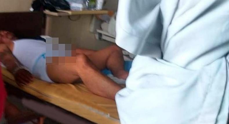 Man in hospital after a 3-day erection from Viagra meant for cattle and the lady didn't show up