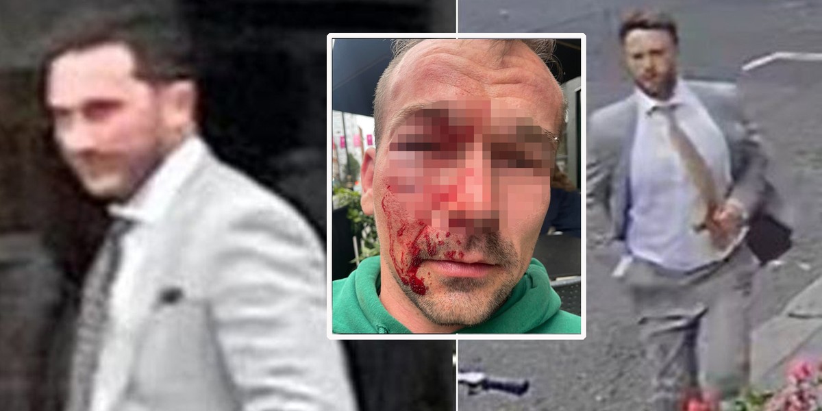 Polak brutalnie pobity w Londynie. Policja poszukuje dwóch mężczyzn. 