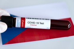 Lekarze rodzinni mogą już zlecać testy na koronawirusa poprzez aplikację