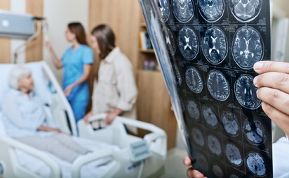 Ne hagyja figyelmen kívül ezeket a stroke utáni jeleket – az idegrendszer károsodására utalhatnak!