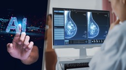 ¿Serán innecesarios los médicos?  Un gran avance en el diagnóstico del cáncer